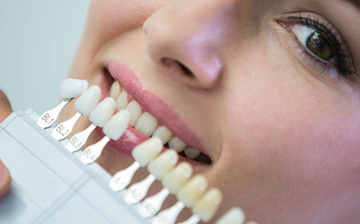 Lamina Porselen Kaplamalar